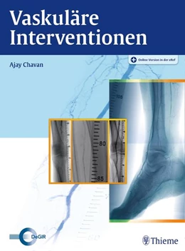 Abbildung von Chavan | Vaskuläre Interventionen | 1. Auflage | 2016 | beck-shop.de