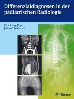 Abbildung von Differenzialdiagnosen in der pädiatrischen Radiologie | 1. Auflage | 2012 | beck-shop.de