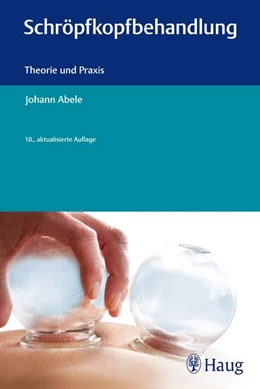 Abbildung von Abele | Schröpfkopfbehandlung | 10. Auflage | 2013 | beck-shop.de