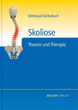Abbildung von Diefenbach | Skoliose | 1. Auflage | 2016 | beck-shop.de