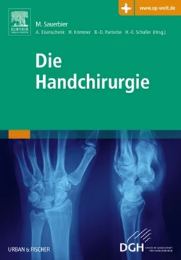 Abbildung von Sauerbier / Eisenschenk | Die Handchirurgie | 1. Auflage | 2014 | beck-shop.de