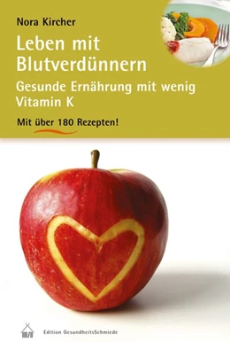 Abbildung von Kircher | Leben mit Blutverdünnern | 1. Auflage | 2014 | beck-shop.de