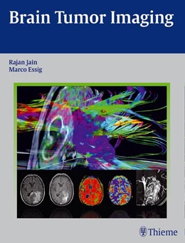 Abbildung von Jain / Essig | Brain Tumor Imaging | 1. Auflage | 2015 | beck-shop.de