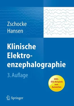 Abbildung von Zschocke / Hansen | Klinische Elektroenzephalographie | 3. Auflage | 2011 | beck-shop.de