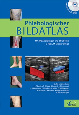 Abbildung von Rabe / Stücker | Phlebologischer Bildatlas | 1. Auflage | 2015 | beck-shop.de