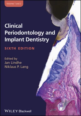 Abbildung von Lindhe / Lang | Clinical Periodontology and Implant Dentistry, 2 Volume Set | 6. Auflage | 2015 | beck-shop.de