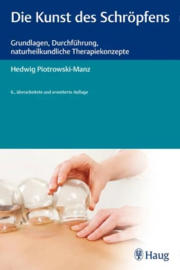 Abbildung von Piotrowski-Manz | Die Kunst des Schröpfens | 6. Auflage | 2015 | beck-shop.de
