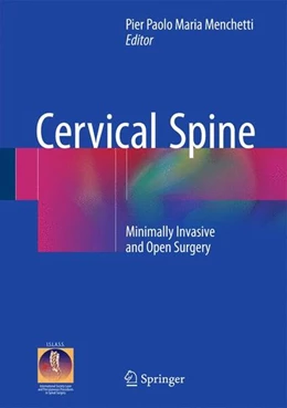 Abbildung von Menchetti | Cervical Spine | 1. Auflage | 2015 | beck-shop.de