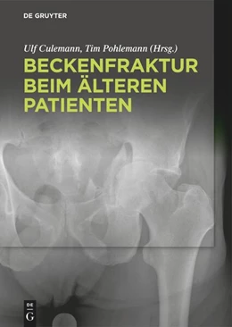 Abbildung von Culemann / Pohlemann | Beckenfraktur beim älteren Patienten | 1. Auflage | 2021 | beck-shop.de