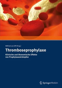 Abbildung von Eiff | Thromboseprophylaxe Klinische und ökonomische Effekte von Prophylaxestrümpfen | 1. Auflage | 2015 | beck-shop.de