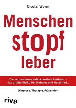 Abbildung von Worm | Menschenstopfleber | 1. Auflage | 2016 | beck-shop.de
