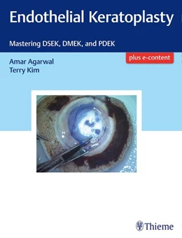 Abbildung von Agarwal / Kim | Endothelial Keratoplasty | 1. Auflage | 2017 | beck-shop.de