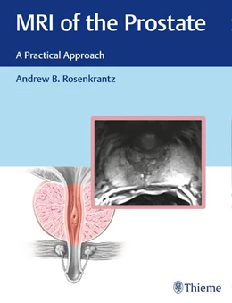 Abbildung von Rosenkrantz | MRI of the Prostate | 1. Auflage | 2017 | beck-shop.de