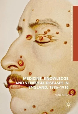 Abbildung von Hanley | Medicine, Knowledge and Venereal Diseases in England, 1886-1916 | 1. Auflage | 2016 | beck-shop.de