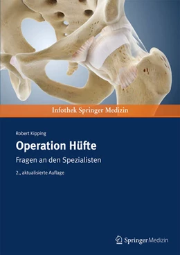 Abbildung von Kipping | Operation Hüfte | 2. Auflage | 2016 | beck-shop.de