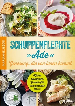 Abbildung von Sebök | Schuppenflechte 