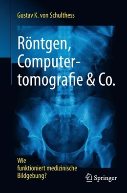 Abbildung von Schulthess | Röntgen, Computertomografie & Co. | 1. Auflage | 2016 | beck-shop.de