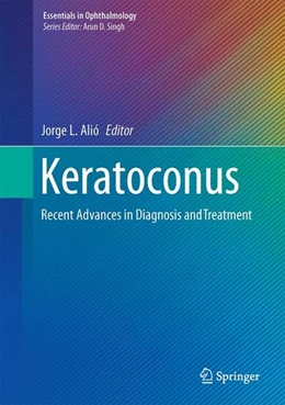 Abbildung von Alió | Keratoconus | 1. Auflage | 2016 | beck-shop.de