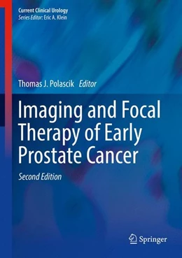 Abbildung von Polascik | Imaging and Focal Therapy of Early Prostate Cancer | 2. Auflage | 2017 | beck-shop.de