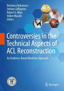 Abbildung von Nakamura / Zaffagnini | Controversies in the Technical Aspects of ACL Reconstruction | 1. Auflage | 2017 | beck-shop.de