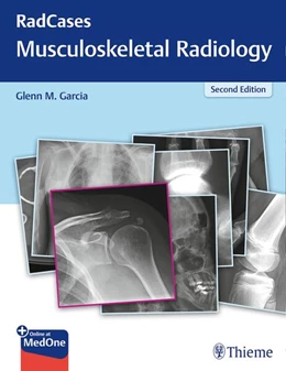 Abbildung von Garcia | Radcases Q&A Musculoskeletal Radiology | 2. Auflage | 2017 | beck-shop.de