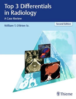 Abbildung von O'Brien | Top 3 Differentials in Radiology | 2. Auflage | 2018 | beck-shop.de