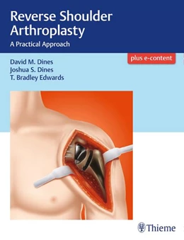 Abbildung von Dines / Edwards | Reverse Shoulder Arthroplasty | 1. Auflage | 2017 | beck-shop.de