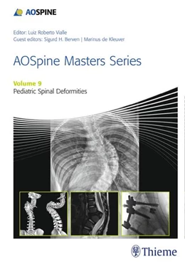 Abbildung von Berven / de Kleuver | Aospine Masters Series, Volume 9: Pediatric Spinal Deformities | 1. Auflage | 2017 | beck-shop.de