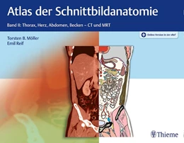 Abbildung von Möller / Reif | Atlas der Schnittbildanatomie • Band II: Thorax, Herz, Abdomen, Becken | 1. Auflage | 2018 | beck-shop.de