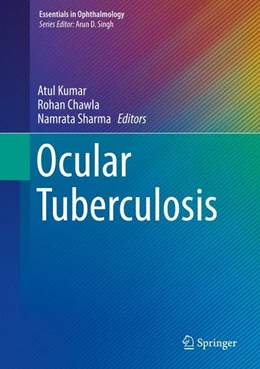 Abbildung von Kumar / Chawla | Ocular Tuberculosis | 1. Auflage | 2017 | beck-shop.de