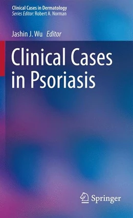 Abbildung von Wu | Clinical Cases in Psoriasis | 1. Auflage | 2017 | beck-shop.de