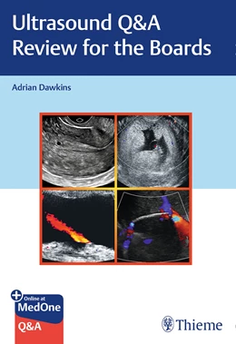 Abbildung von Dawkins | Ultrasound Q&A Review for the Boards | 1. Auflage | 2020 | beck-shop.de