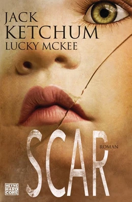 Abbildung von Ketchum / McGee | SCAR | 1. Auflage | 2017 | beck-shop.de