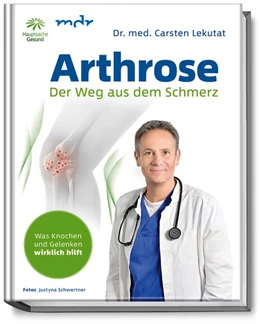 Abbildung von Lekutat | Arthrose | 1. Auflage | 2018 | beck-shop.de