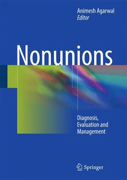 Abbildung von Agarwal | Nonunions | 1. Auflage | 2017 | beck-shop.de