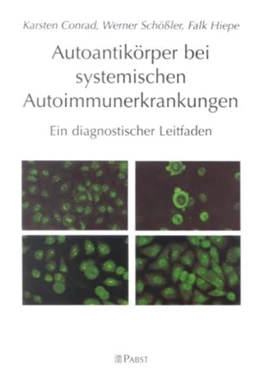 Abbildung von Conrad / Schößler | Autoantikörper bei systemischen Autoimmunerkrankungen | 1. Auflage | 2001 | beck-shop.de