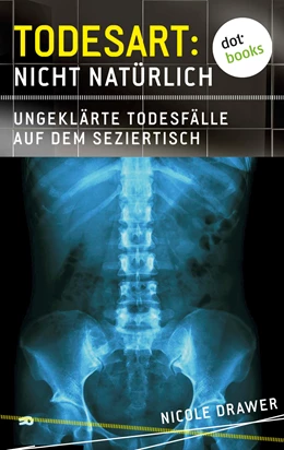 Abbildung von Drawer | Todesart: Nicht natürlich. Ungeklärte Todesfälle auf dem Seziertisch: True Crime 2 | 1. Auflage | 2015 | beck-shop.de