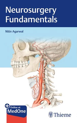 Abbildung von Agarwal | Neurosurgery Fundamentals | 1. Auflage | 2019 | beck-shop.de