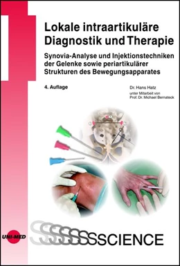 Abbildung von Hatz | Lokale intraartikuläre Diagnostik und Therapie - Synovia-Analyse und Injektionstechniken der Gelenke | 4. Auflage | 2018 | beck-shop.de