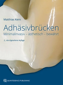 Abbildung von Kern | Adhäsivbrücken | 2. Auflage | 2018 | beck-shop.de