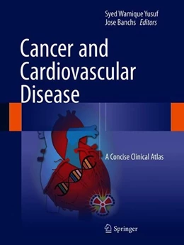 Abbildung von Yusuf / Banchs | Cancer and Cardiovascular Disease | 1. Auflage | 2018 | beck-shop.de