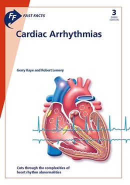 Abbildung von Kaye / Lemery | Fast Facts: Cardiac Arrhythmias | 3. Auflage | 2018 | beck-shop.de
