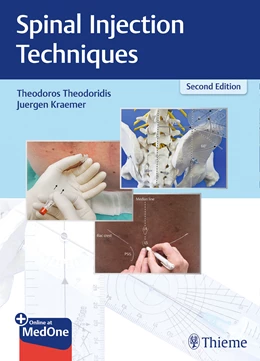 Abbildung von Theodoridis / Krämer | Spinal Injection Techniques | 2. Auflage | 2019 | beck-shop.de