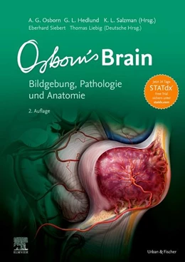 Abbildung von Osborn / Hedlund | Osborn's Brain | 2. Auflage | 2019 | beck-shop.de