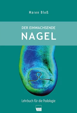 Abbildung von Bloß | Der eingewachsenen Nagel | 1. Auflage | 2019 | beck-shop.de