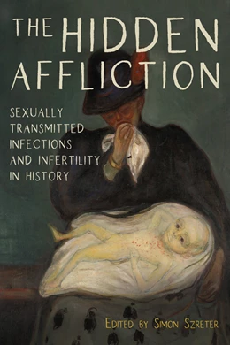 Abbildung von Szreter | The Hidden Affliction | 1. Auflage | 2019 | 46 | beck-shop.de