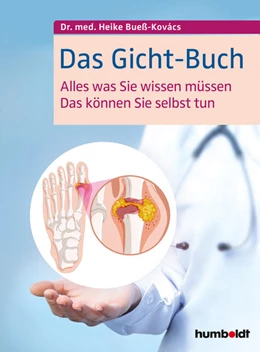 Abbildung von Bueß-Kovács | Das Gicht-Buch | 1. Auflage | 2019 | beck-shop.de