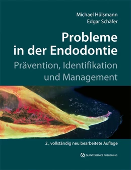 Abbildung von Hülsmann / Schäfer | Probleme in der Endodontie | 2. Auflage | 2019 | beck-shop.de