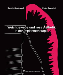 Abbildung von Cardaropoli / Casentini | Weichgewebe und rosa Ästhetik in der Implantattherapie | 1. Auflage | 2019 | beck-shop.de