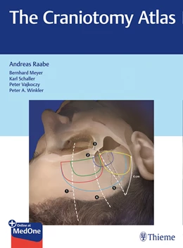 Abbildung von Raabe | The Craniotomy Atlas | 1. Auflage | 2019 | beck-shop.de